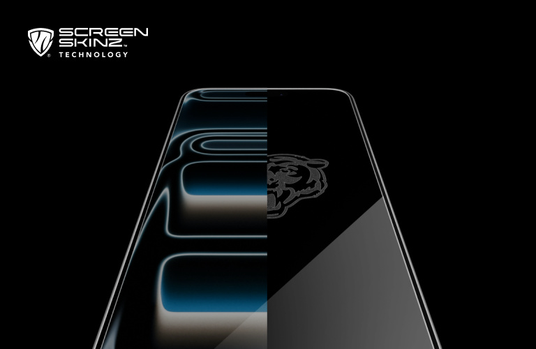 Dark promotional banner featuring the Screen Skinz Technology logo on the left and a stylized close-up of a smartphone on the right, split to show a glowing layered design on one side and a glossy, protected surface on the other, suggesting screen protection technology.